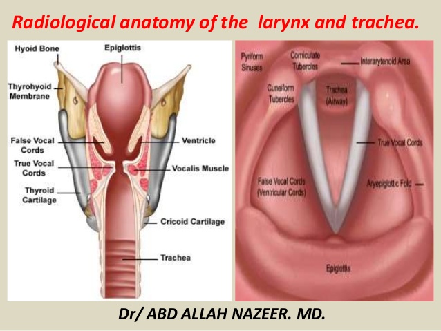 presentation1pptx-radiological-anatomy-of-the-larynx-and-trachea-1-638